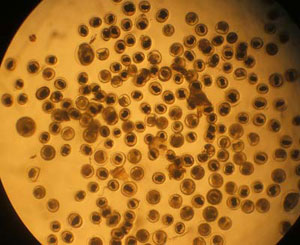 Picture 3 of Be wary of lung fluke