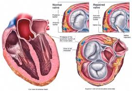 Picture 1 of Beta blockers reduce the risk of death of cardiovascular patients after surgery