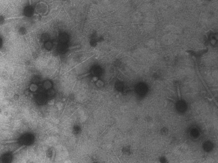 Picture 3 of Billions of viruses are falling on our heads every day without anyone knowing