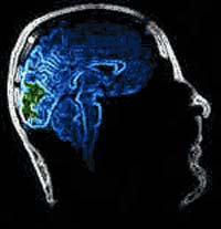 Picture 1 of Biological chips help to re-communicate contact lines in the brain