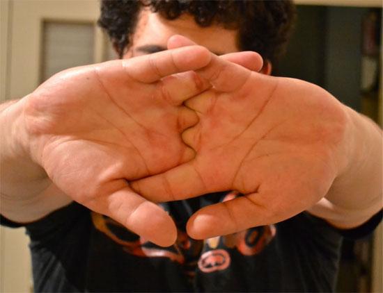 Picture 4 of Biting nails, belching ... is healthy