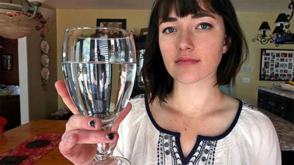Picture 1 of Bizarre of water allergy