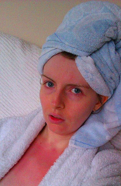Picture 2 of Bizarre of water allergy