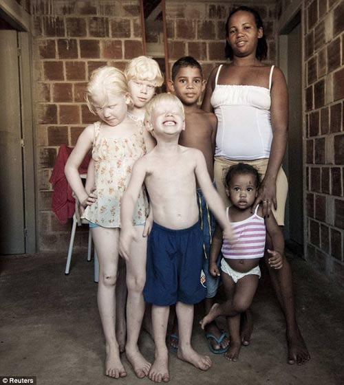 Picture 1 of Black couple gave birth to three white children