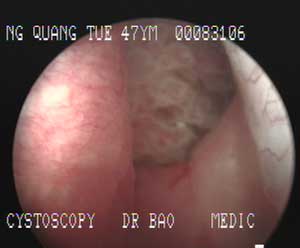 Picture 1 of Bladder bladder