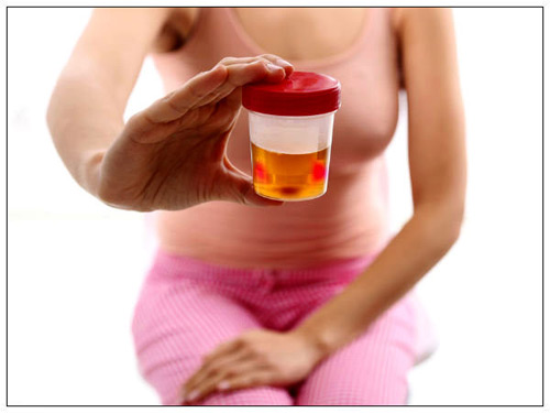 Picture 1 of Bladder cancer is very scary, women must know these signs