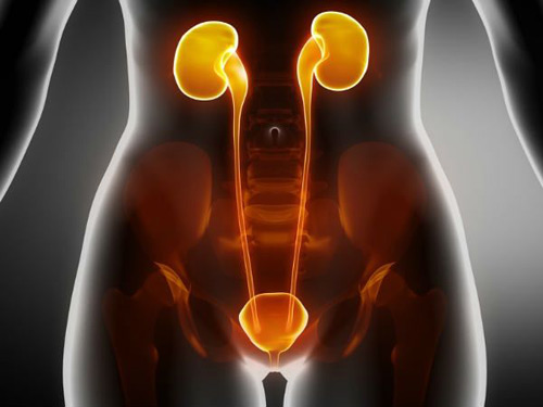 Picture 2 of Bladder cancer is very scary, women must know these signs