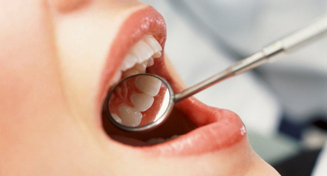 Picture 1 of Bleeding from the teeth, little blood loss but not taken lightly