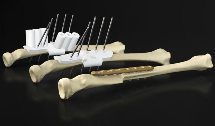 Picture 3 of Body parts are gradually being mass produced