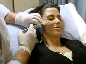 Picture 1 of Botulic toxin: Effective for beauty and healing