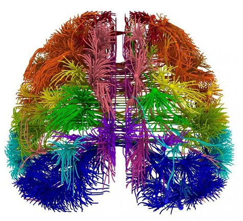 Picture 3 of Brain diagram in the style of rainbow colors