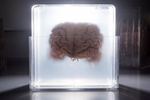 Picture 2 of 'Brain digitization' as in Matrix: Does this scenario happen to humanity in the future?