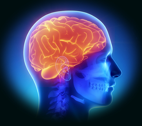 Picture 1 of Brain implants are useful for Parkinson's patients