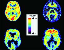 Picture 4 of Brain problem