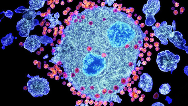 Picture 2 of Breakthrough: Detecting antibodies can kill 99% of the HIV virus strain