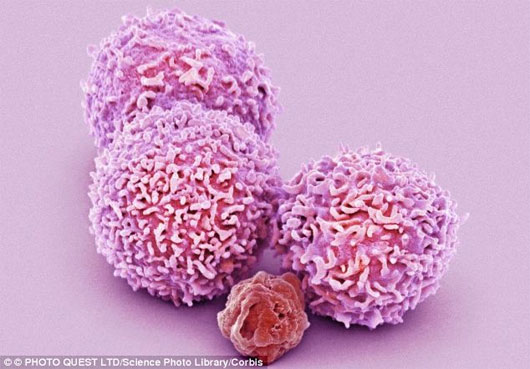 Picture 1 of Breakthrough kill metastatic cancer cells