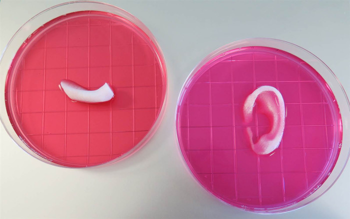 Picture 3 of Breakthrough technology: Successful 3D printing of human ears with blood vessels and cartilage