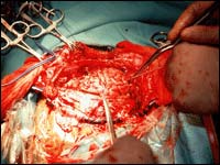 Picture 1 of Breakthroughs in the field of microsurgery
