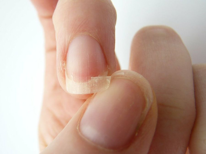 Picture 2 of Broken nails: 6 common causes and quick fixes