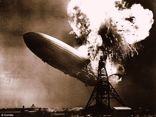 Picture 2 of Burns from balloons exploded - explaining phenomena