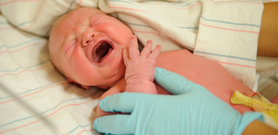 Picture 1 of Caesarean babies are allergic