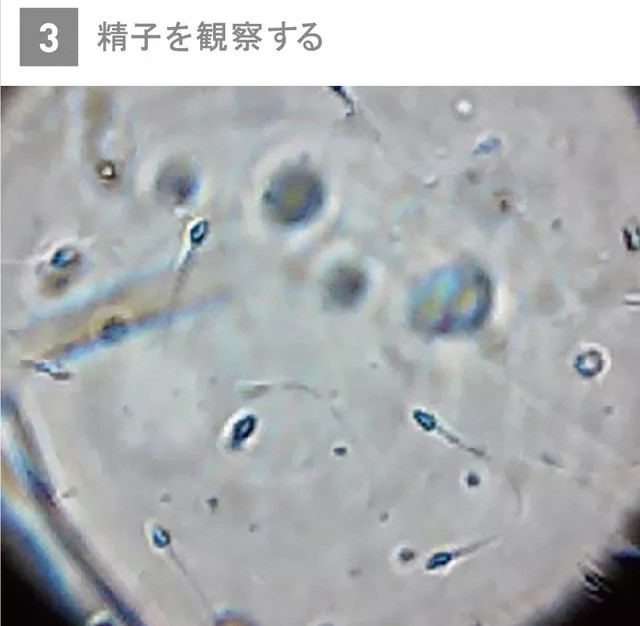 Picture 7 of Can check the quality of male sperm with smartphones