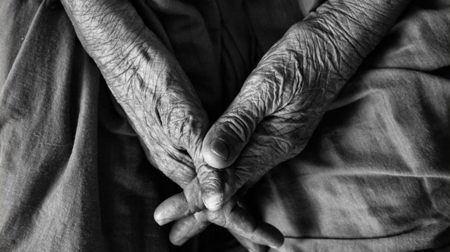 Picture 4 of Can humans live up to 10 times longer?