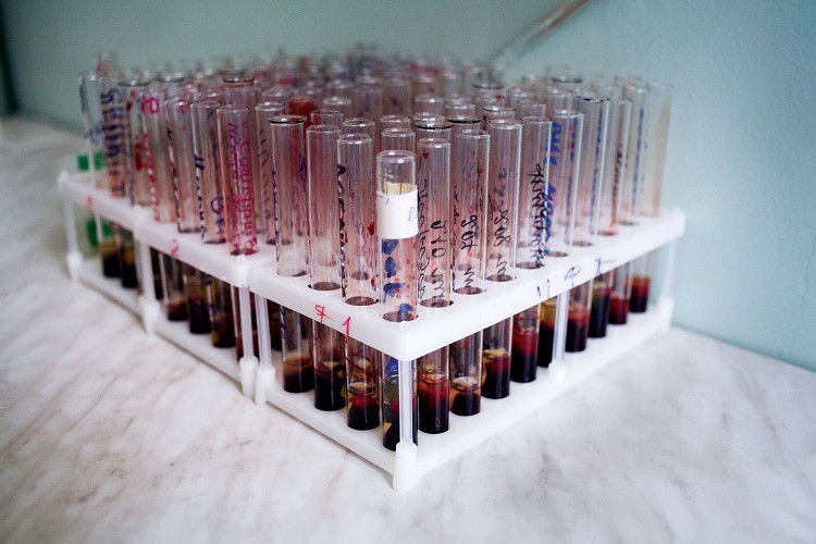 Picture 1 of Can marrow transplant kill HIV cells?