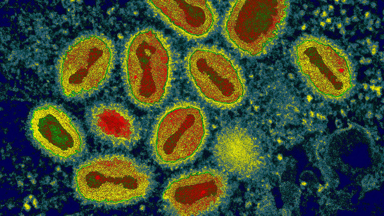 Picture 2 of Canadian scientist 'revives' the extinct virus that once killed 500 million people