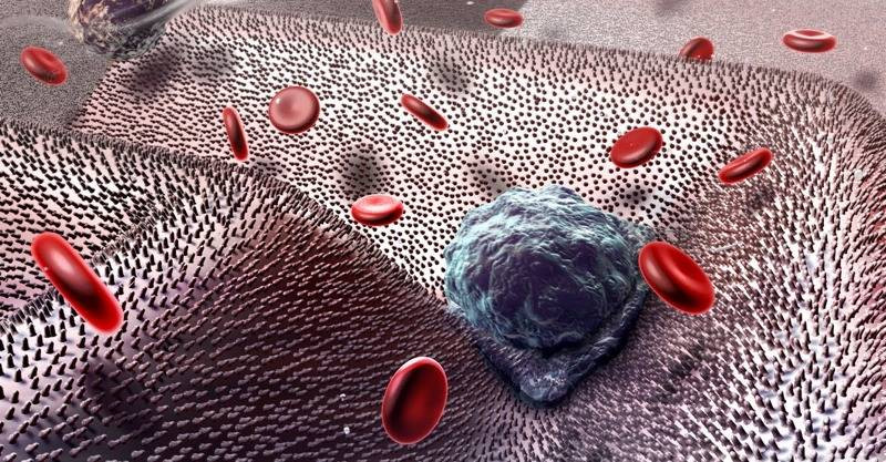 Picture 1 of Cancer cells spread in the body in a more frightening way than you think