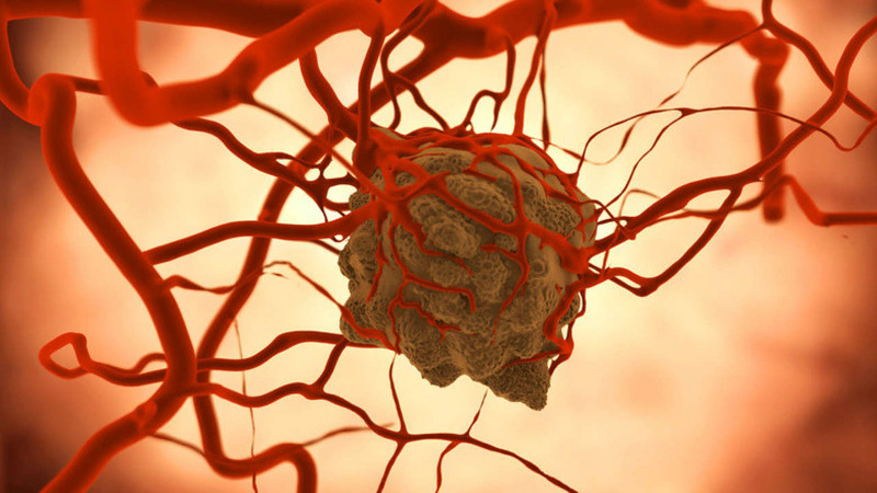 Picture 2 of Cancer cells spread in the body in a more frightening way than you think