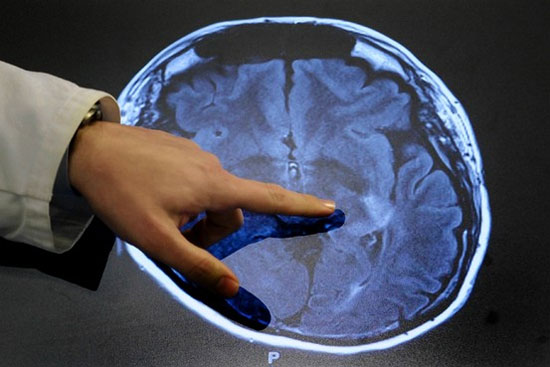 Picture 1 of Cancer drug prevents transplant rejection