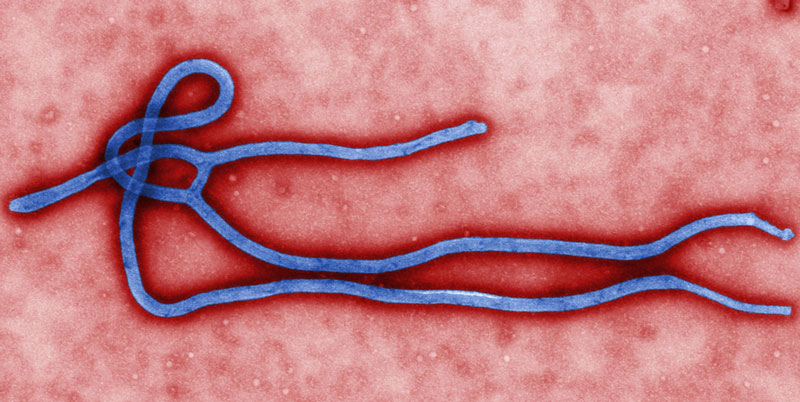 Picture 1 of Cancer drugs can prevent Ebola virus