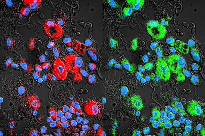 Picture 3 of Cancer patients will no longer suffer side effects thanks to new research