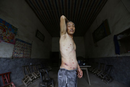 Picture 2 of Cancer village in China