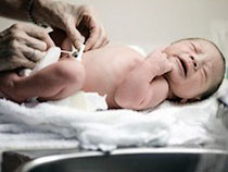 Picture 1 of Care of newborn umbilical cord