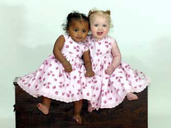 Picture 3 of Cases of strange genetic changes in the world