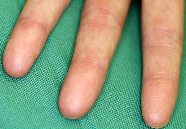 Picture 4 of Cases of strange genetic changes in the world