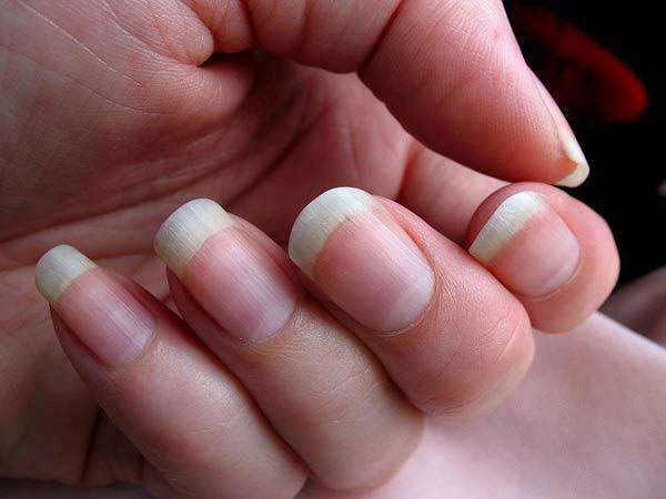Picture 1 of Cause nails grow faster than toenails