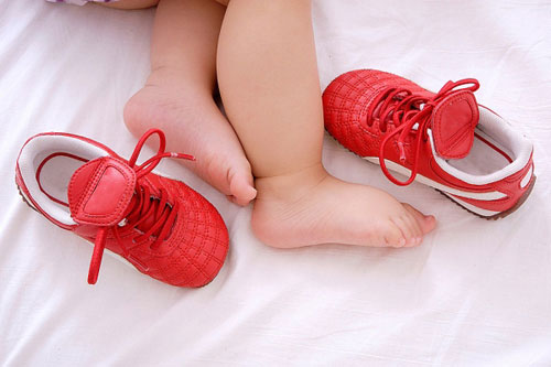 Picture 3 of Causes and ways of coping when children sweat a lot of hands and feet
