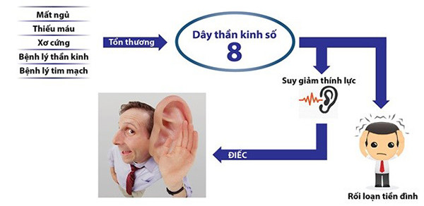 Picture 2 of Causes of tinnitus and treatment
