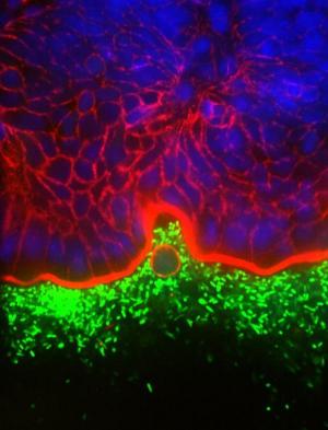 Picture 1 of Cell sacrifices for the common good