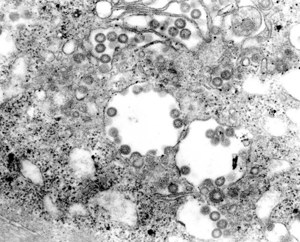 Picture 4 of Check out the most dangerous viruses on the planet
