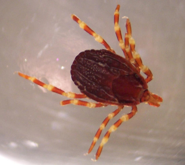 Picture 7 of Check out the most dangerous viruses on the planet