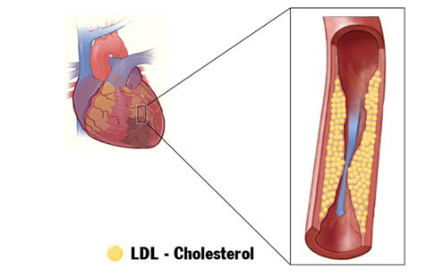 Picture 2 of Chest tightness, difficulty breathing - Can't be underestimated
