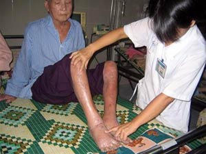 Picture 1 of Chinese medicine 'poisoning' poison ... poison