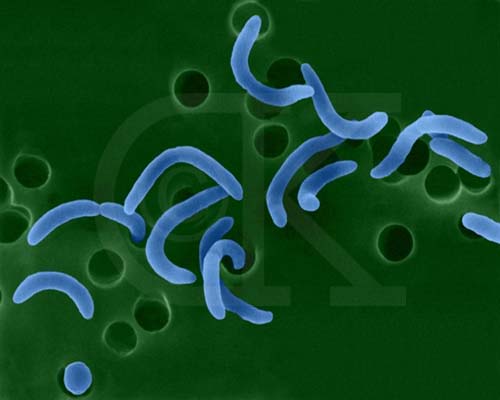 Picture 1 of Cholera bacteria are more aggressive due to structural changes