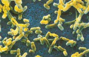 Picture 1 of Climate change increases plague