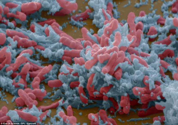 Close up of beautiful deadly bacteria surprised