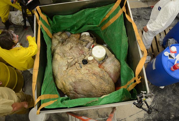 Picture 2 of Close up of the heart